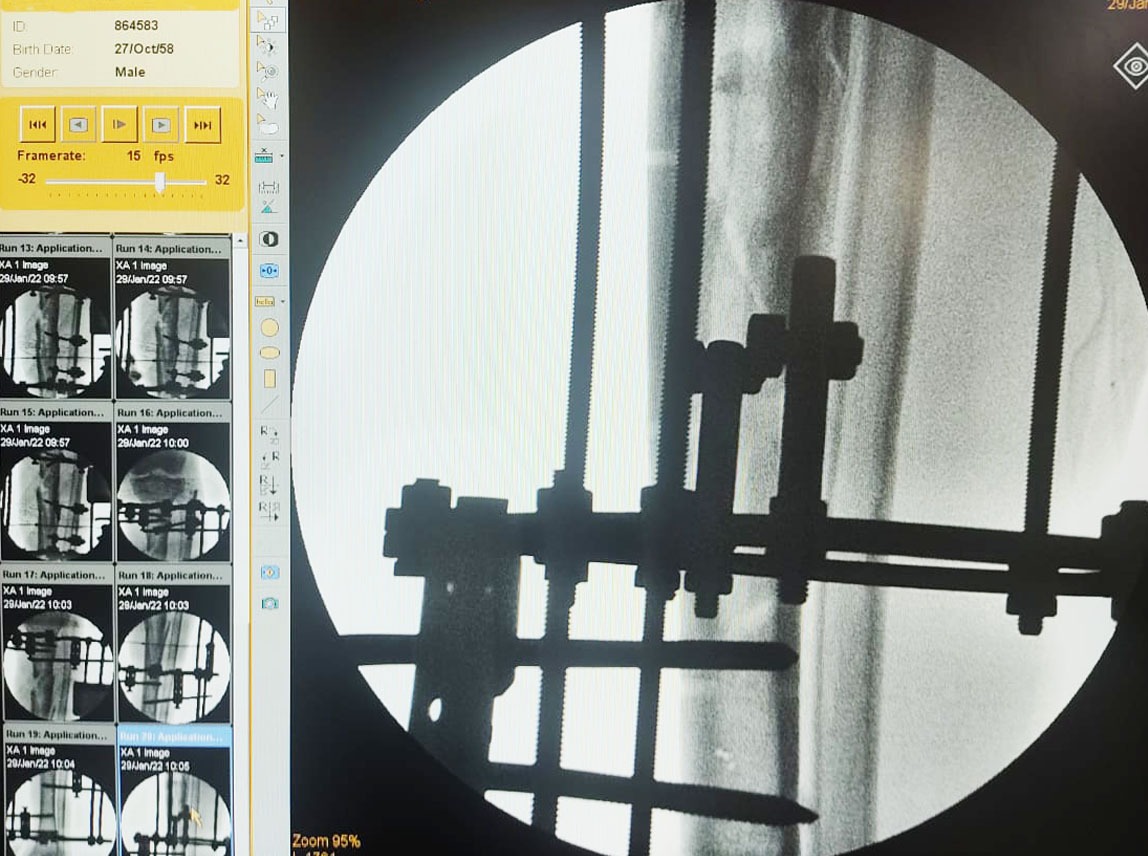 FOTO_RX Cirurgia Ortopedica-6aa1e2b9