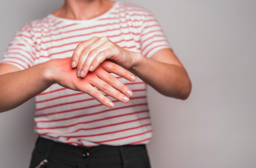 Lúpus é uma doença autoimune que afeta mais as mulheres